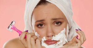 hirsutism
