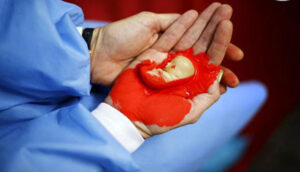 Re-abortion