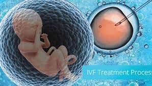 about IVF