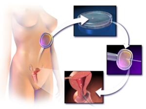 Embryo Implantation