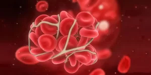 سندرم آنتی فسفولیپید