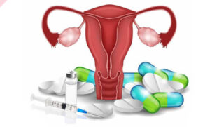 قبل از تخمک کشی