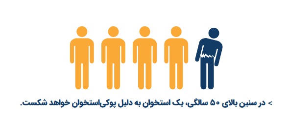 پوکی استخوان در مردان
