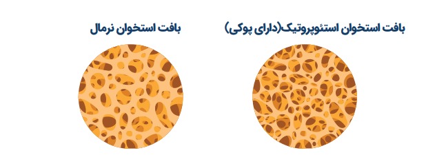 بافت استخوان